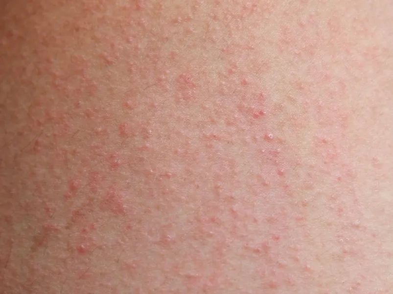 建水人关注了这东西不能碰,来建水了要关注什么