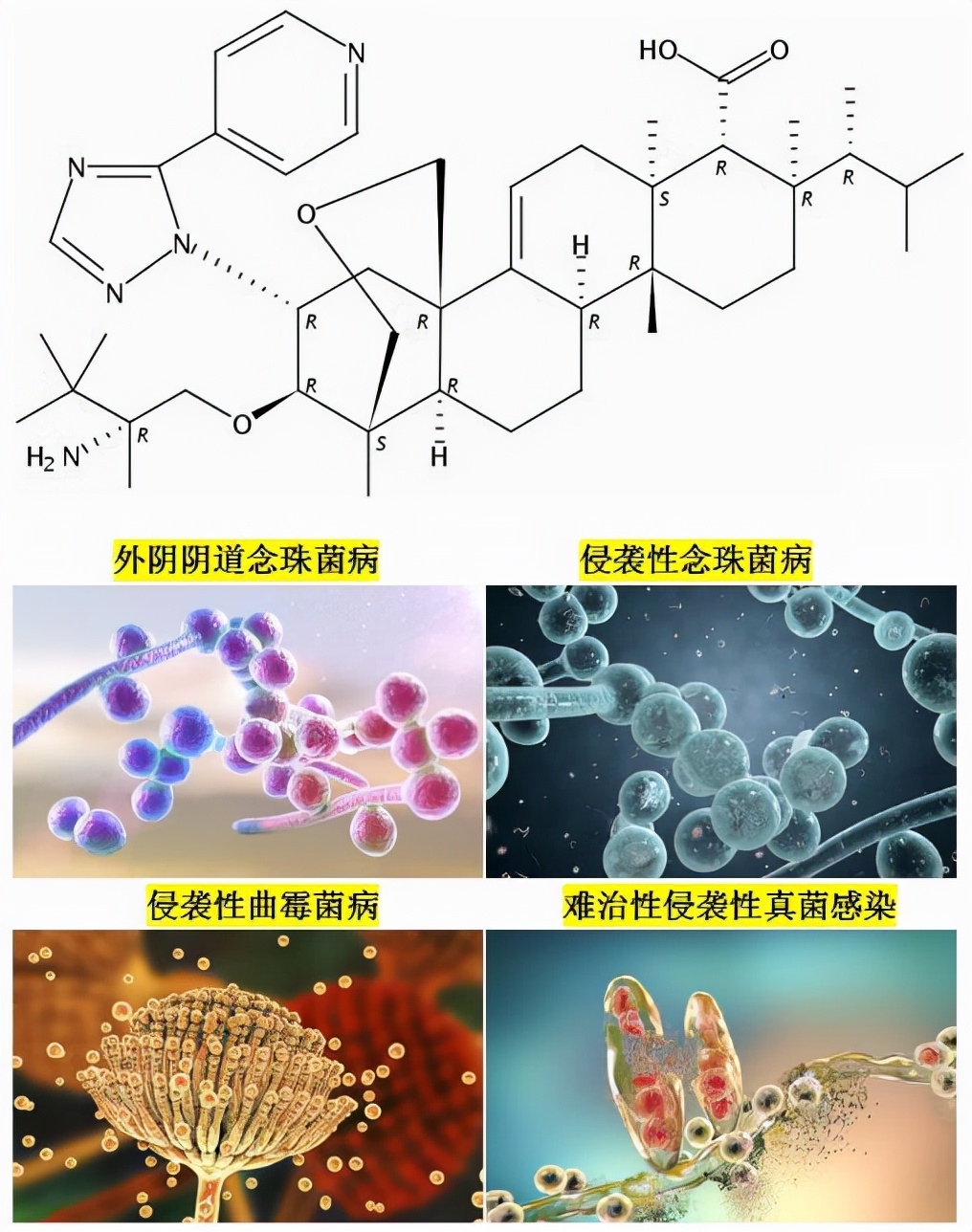最新一代抗真菌药,新一代广谱抗真菌药