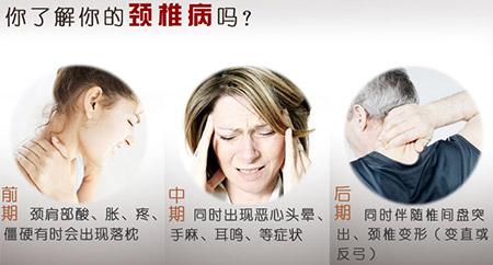 我的颈椎病是神经根型颈椎病如何保守治疗不希望手术