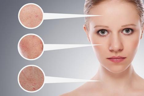 黑色痘印怎么能彻底消除,黑色痘印怎么消除小妙招视频