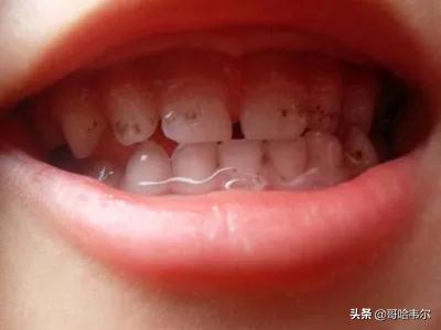 买奶粉最关心哪些成分,买奶粉货比三家