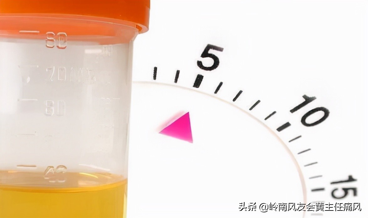 预防痛风药物,痛风预防知识痛风的治疗