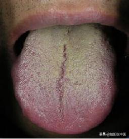 我38岁一直痛经怎么治,我与爷爷学中医养生