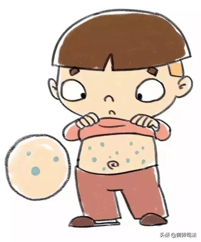 水痘高发季怎样做才能避免中招,水痘高发期预防关注事项