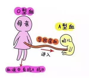 家有“小黄人”宝宝可不是闹着玩儿的！分清新生儿黄疸很重要