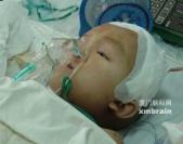 孩子的头偏小怎么办,孩子扁头偏头