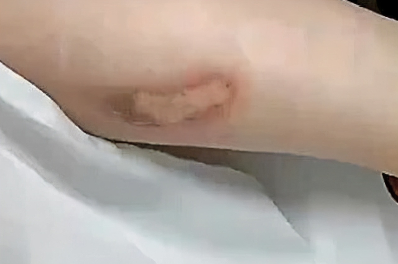 女子第一次坐奔驰大G，小腿被排气管烫伤：连我爸的摩托都不如