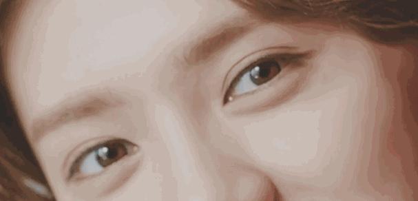 关晓彤有没有黑眼圈,关晓彤黑眼圈困扰