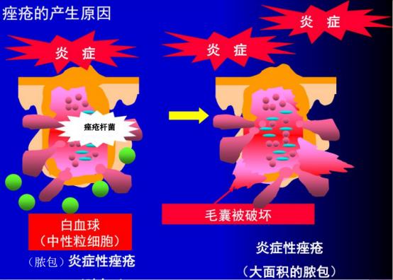 浠欎汉鎺岀棙鑲屼慨鎶よ啅,鐪嬪畬鐥樼棙浠ュ悗鎰熻鏇翠弗閲嶄簡
