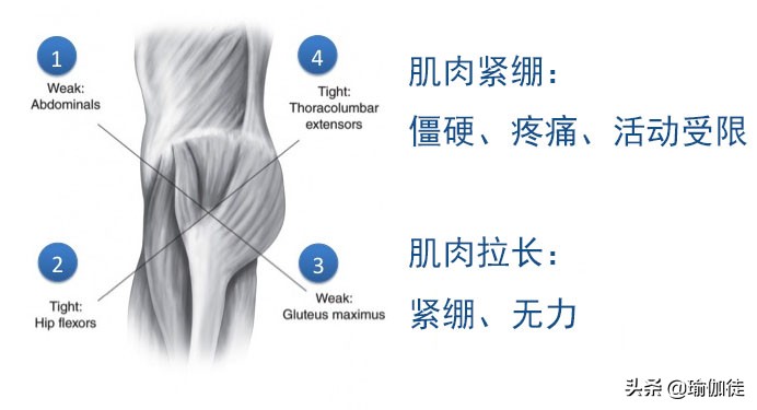 翘屁股影响发育吗,翘二郎腿骨盆倾斜危害