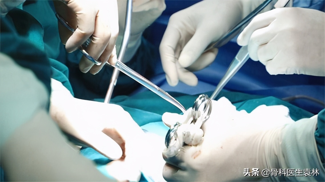 股骨头坏死几期才适合做手术,股骨头坏死做手术多少钱