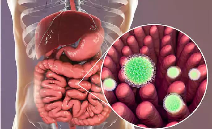 一岁宝宝轮状病毒感染发烧怎么办,腹泻发烧是病毒还是细菌