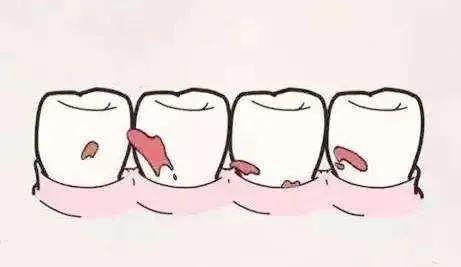 牙科医生检查小朋友口腔,口腔门诊免费窝沟封闭申请