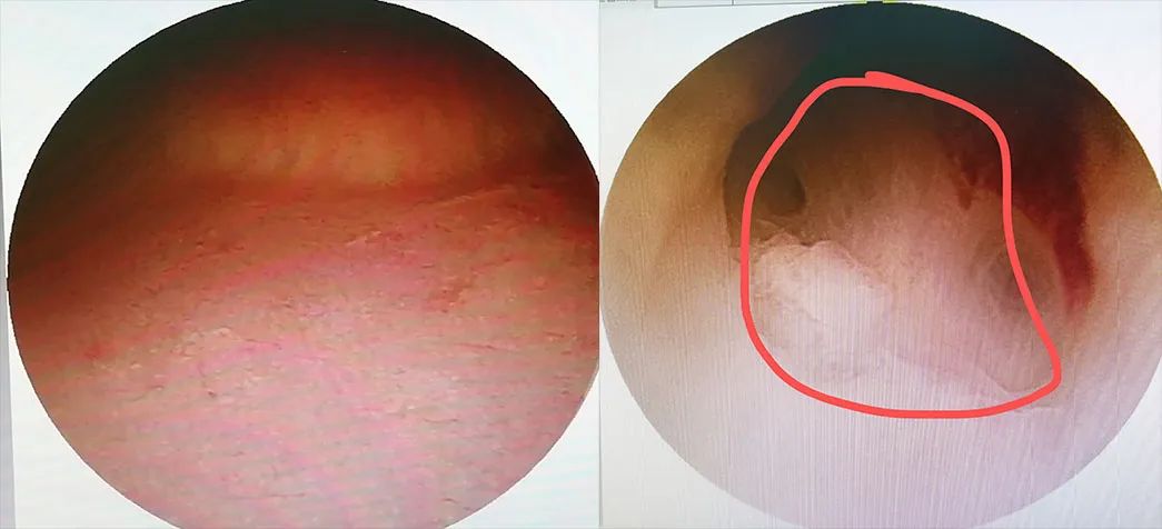 这个难言之隐，所有女生都不应该回避