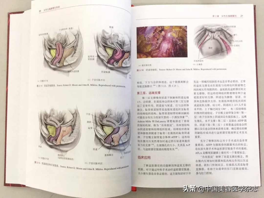 新书推荐▏陈敏亮教授主译《女性生殖器整形美容》