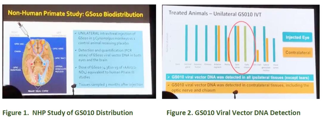 基因治疗青光眼的新消息,基因治疗青光眼的最新消息