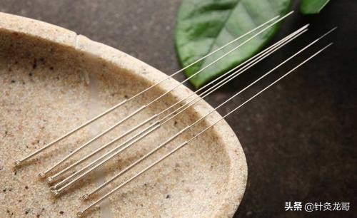 针灸疗法可以治疗哪些疾病,针灸特殊穴位有哪些