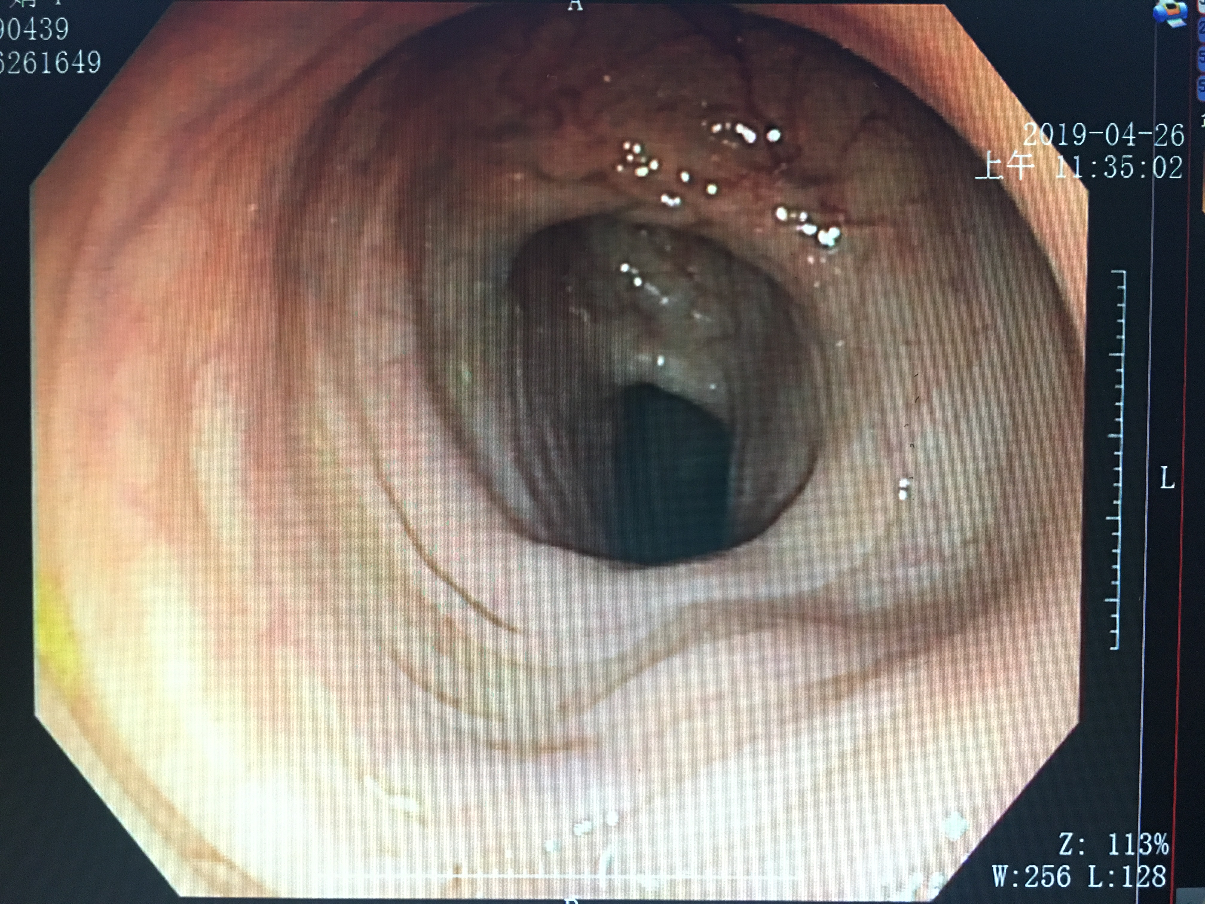 医生说的检查项目我们都必须做吗,医生告诉你应该做哪些检查