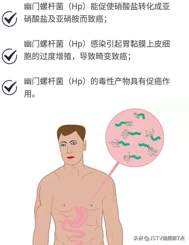 胃癌肠梗阻症状及治疗,胃癌最明显的一个征兆怎么治疗