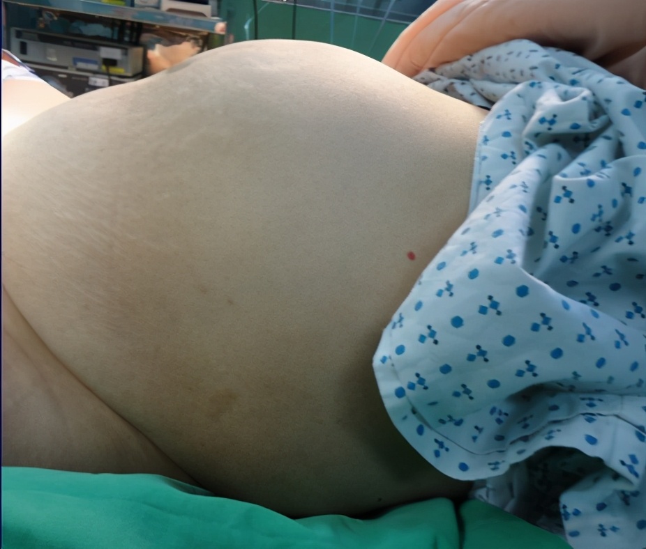 子宫常见肿瘤有哪些,子宫肿瘤3斤是什么肿瘤