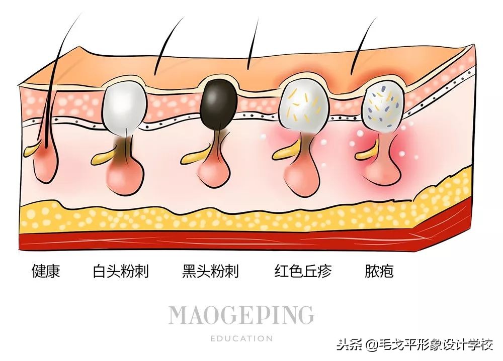 十大谣言护肤骗局揭秘图片,2018十大护肤谣言