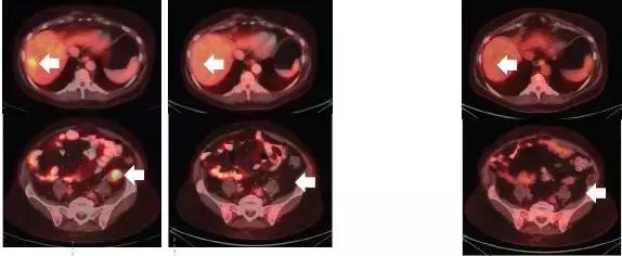 国外最新的抗癌药叫什么名字,美国十大抗癌药物排名