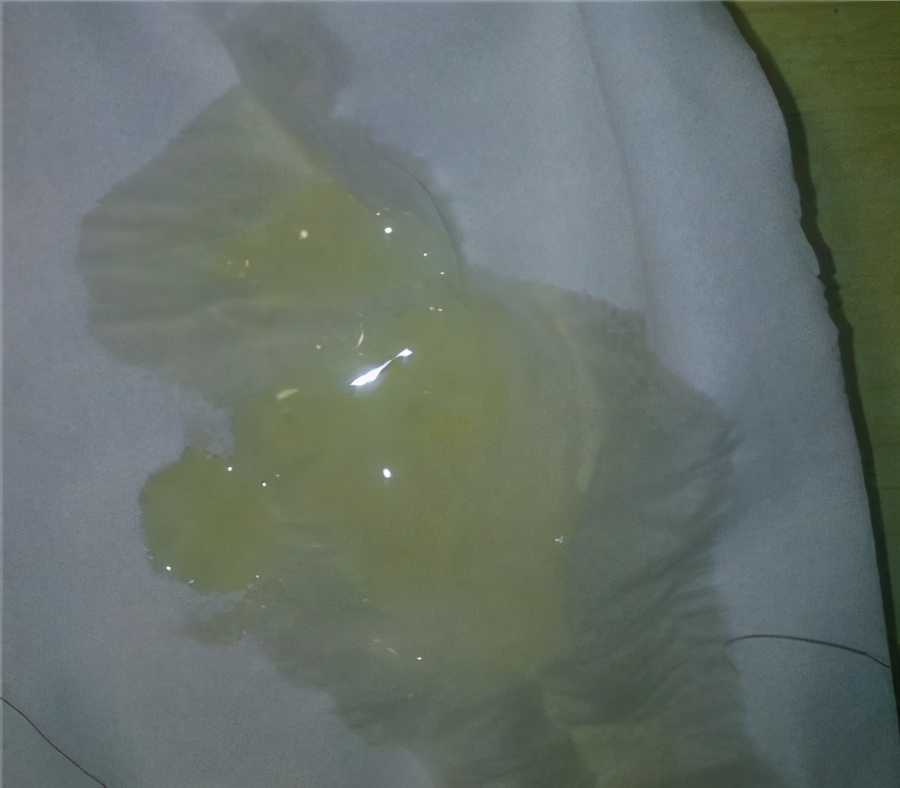 精子出现小蝌蚪咋回事,男性的精子呈褐色正常吗