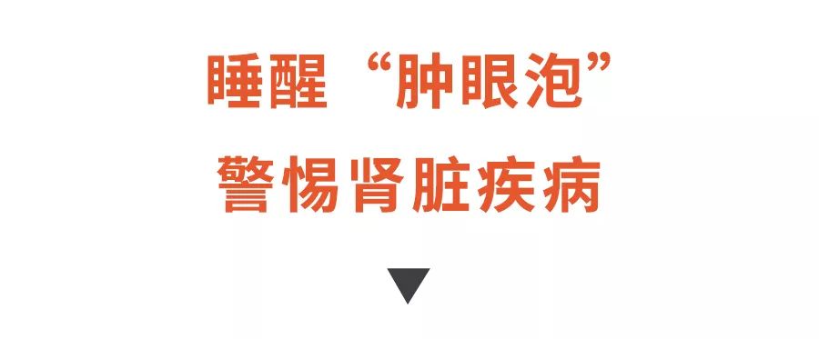 长期身体浮肿要警惕四种病,长期水肿吃什么药有效