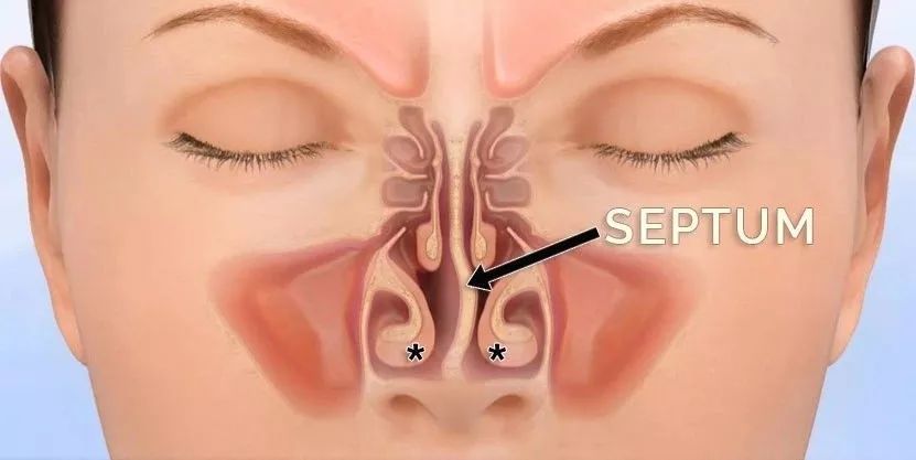 人为啥喜欢挖鼻屎,为什么我们爱抠鼻屎