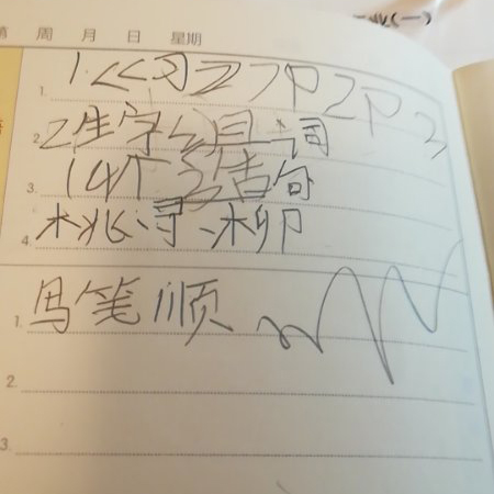 一例读写障碍孩子诊断及矫治方案报告
