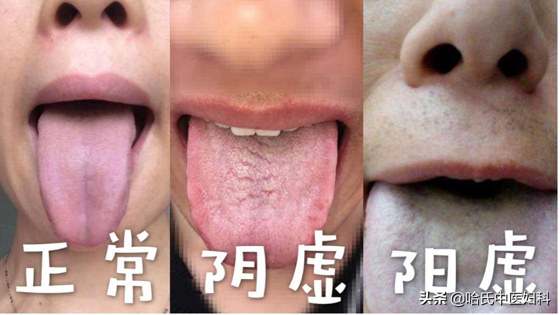 卵泡长不大萎缩怎么备孕,卵泡长不大怎么锻炼身体