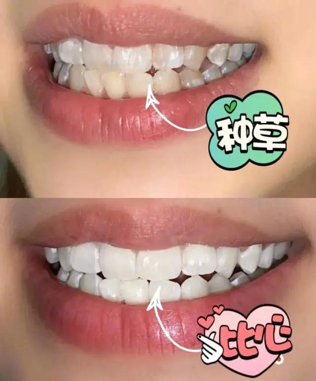 一张嘴就臭,一张嘴就口臭小妙招