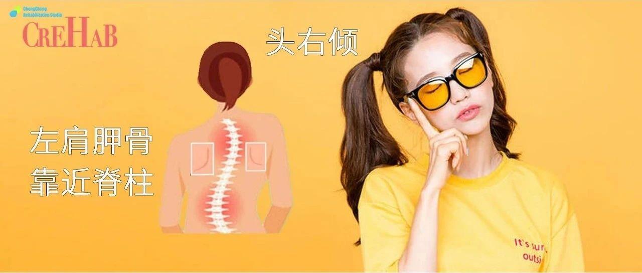 体态矫正训练斜颈,如何锻炼斜颈