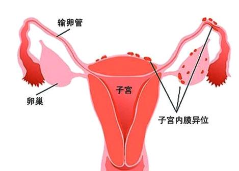 美思伊人：子宫的危害你知道多少吗？