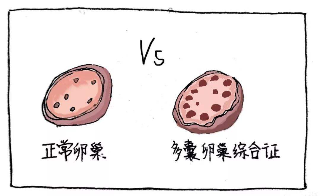 爱美女子如何能忍受自己多毛呢？“多毛症”的前世今生，请看此文