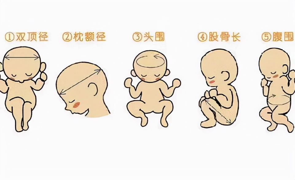 股骨短一定是侏儒症吗,股骨偏短的原因是什么