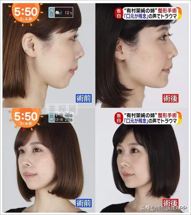 凸嘴女孩的发型侧面好看,水原希子是什么脸型