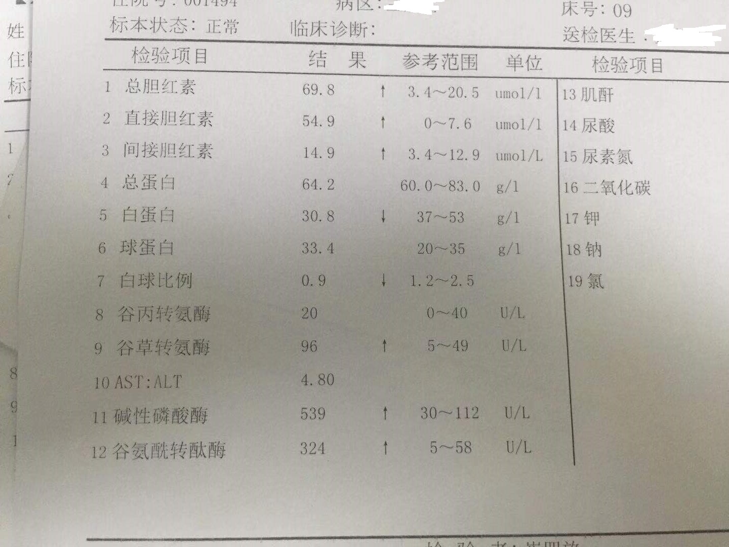 转氨酶过高会传染吗,转氨酶过高有什么危害