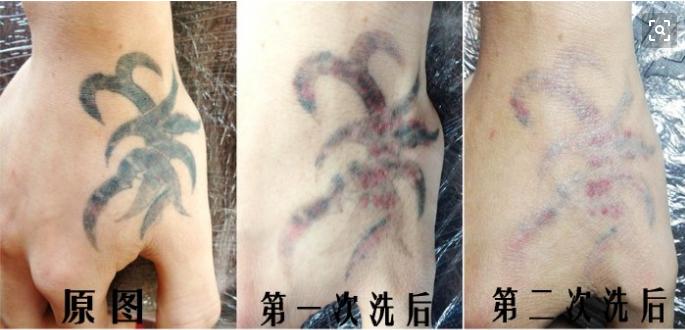 为什么眉毛可以洗掉纹身很难洗掉,洗眉毛纹身的正确方法