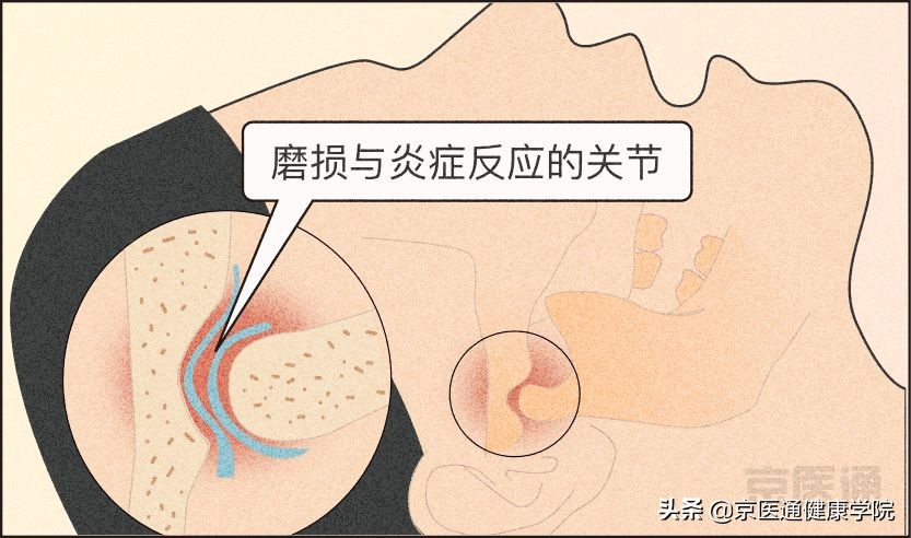 夜磨牙有什么危害吗,夜磨牙的危害