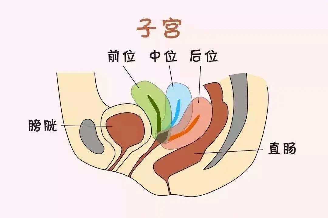 医生说子宫后位有点严重怀孕困难,子宫后位怀孕后会不会有什么影响
