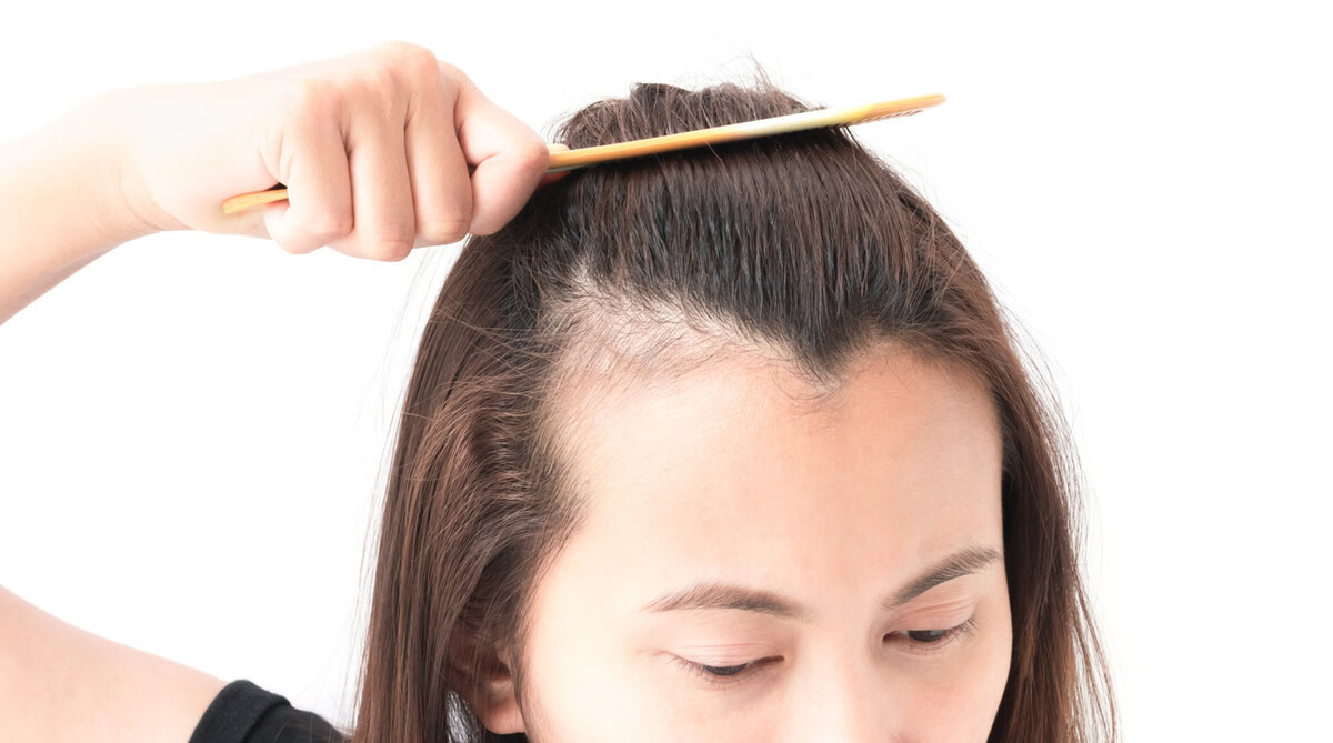 发际线高显老怎么办,发际线高最简单的补救方法