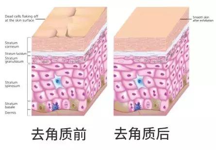 角质层怎么用视频教程,角质层薄怎么涂护肤品