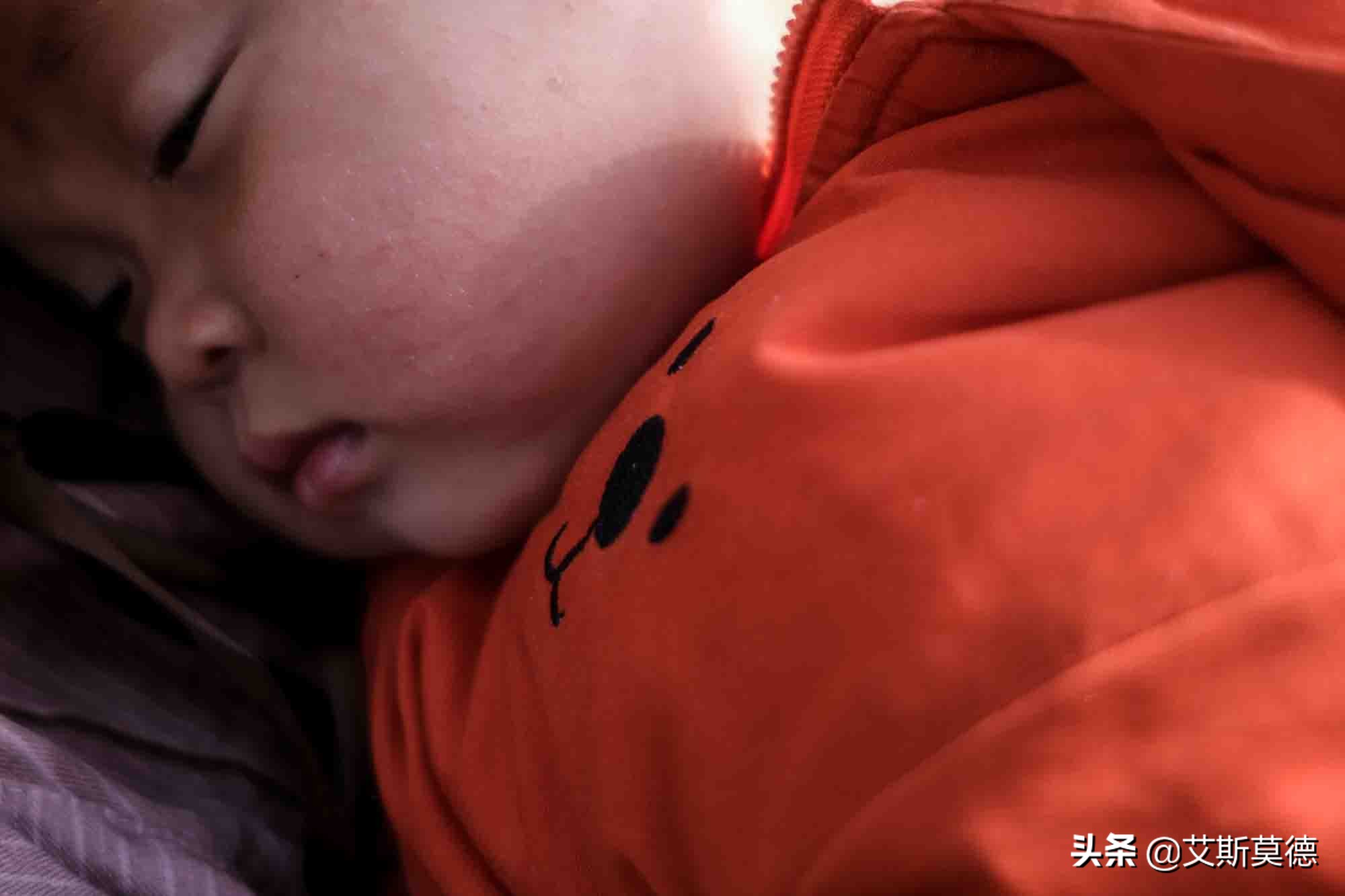 先天性免疫缺陷移植成功率,一岁半的孩子免疫力低