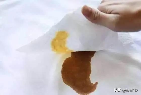 衣服上有污渍怎么清理掉,衣服粘上的污渍怎样去除