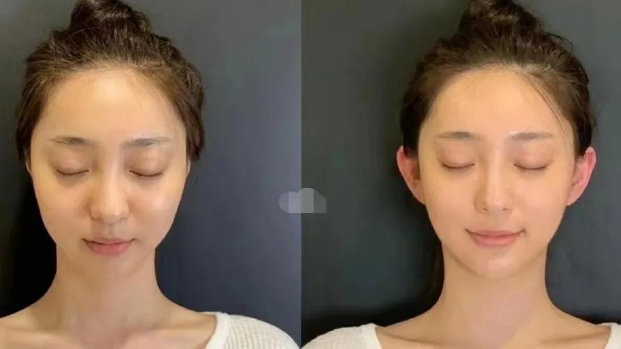 面部的美学曲线,面部艺术美学