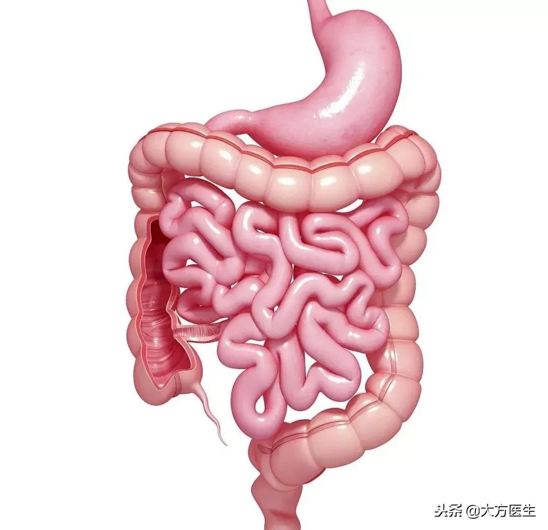 结肠癌晚期转移脑部的表现,结肠癌晚期肠梗阻的表现