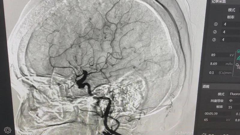 dsa鍖荤敓鎷涜仒2021,dsa涓村簥鍩硅