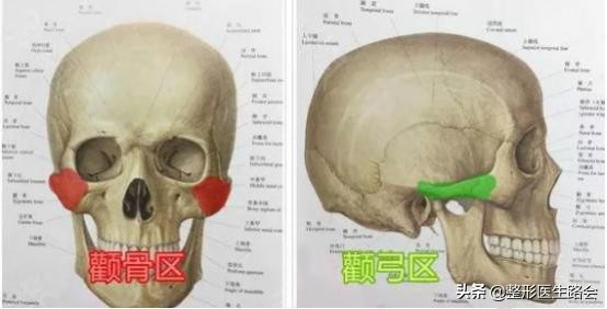 颧骨高到底需不需要整容,颧骨高到底要不要磨骨
