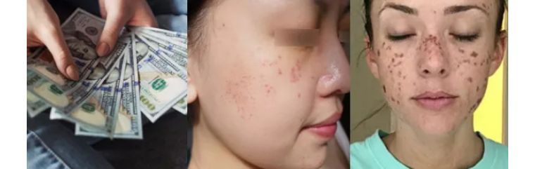 如何避免频繁戴口罩引起皮肤问题,戴口罩后护肤关注什么